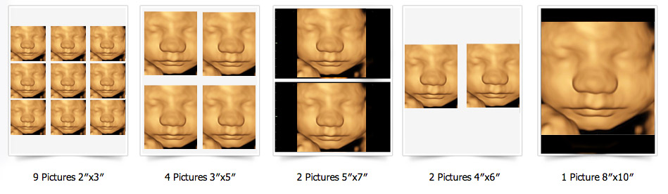 All Photo Print Layout of 3D 4D ultrasound
