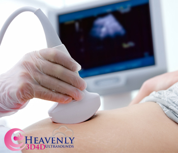 3D 4D Baby Ultrasound