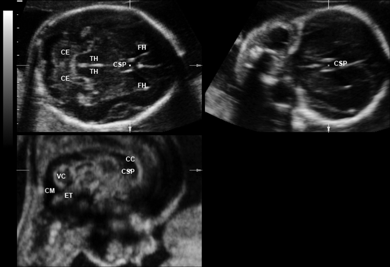 Fetal Ultrasound Anatomy - Anatomical Charts & Posters